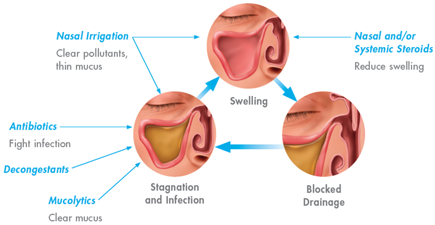 Medical therapy can be an effective way to treat sinus problems in Allen Park & Southfield.