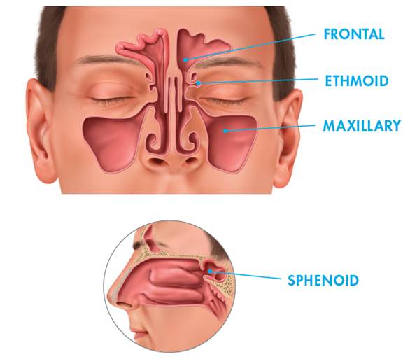 There are four main categories of sinuses: frontal, ethmoid, maxillary, & sphenoid.