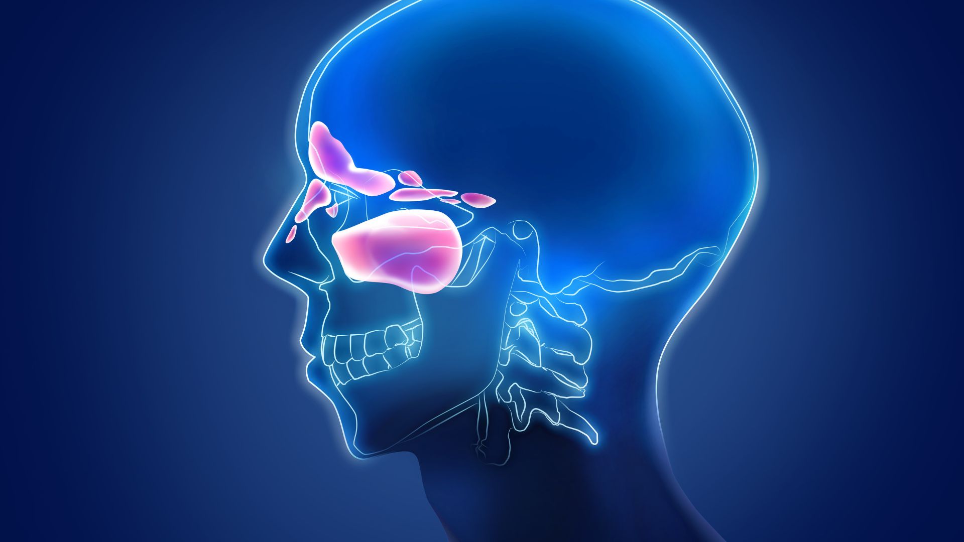 The Role of Antibiotics in Sinusitis Treatment